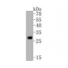 Anti-TREM2 antibody