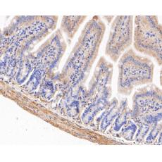 Anti-SAP97 antibody