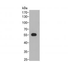 Anti-PHR2 antibody