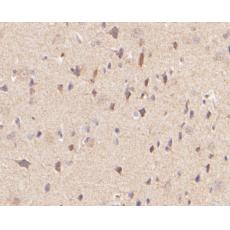 Anti-P2RX5 antibody