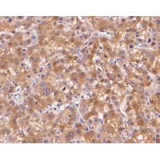 Anti-CBR1 antibody