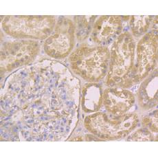 Anti-IRS1 antibody