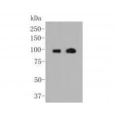Anti-Androgen Receptor antibody