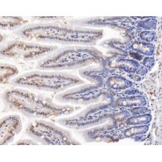 Anti-CDKN2A/p16INK4a antibody