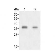Anti-AKR1B1 antibody
