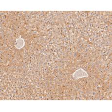 Anti-LSS antibody