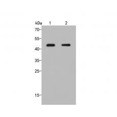 Anti-Rad51B antibody