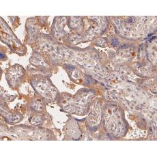 Anti-SERPING1 antibody