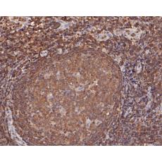Anti-MST1 antibody