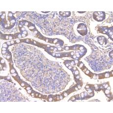 Anti-NLK antibody