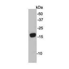 Anti-ATG12 antibody