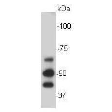 Anti-KLHL15 antibody
