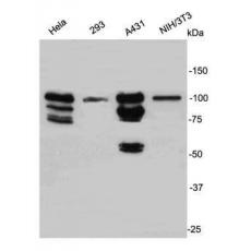 Anti-STAT1 antibody