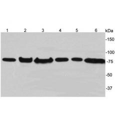 Anti-ERp72 antibody