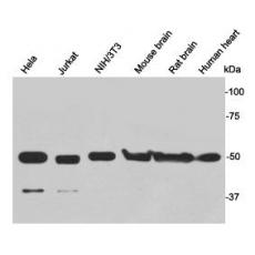 Anti-Gamma tubulin antibody