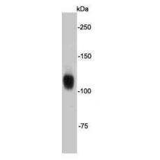 Anti-FGFR2/CD332 antibody