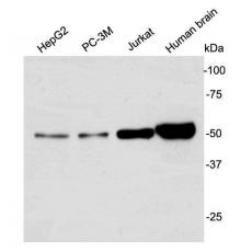 Anti-GSK3 alpha antibody