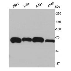 Anti-Ku70 antibody
