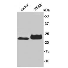 Anti-AK6 antibody