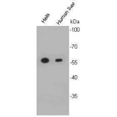 Anti-ALDH2 antibody