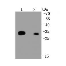 Anti-HLA-DR antibody