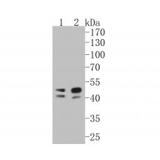 Anti-TMX4 antibody