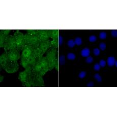 Anti-WDR5 antibody