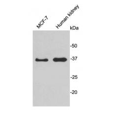 Anti-HADH antibody