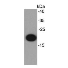 Anti-IL-6 antibody
