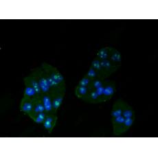 Anti-MSH2 antibody