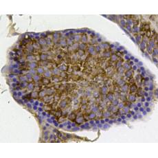 Anti-YBOX1 / YB-1 antibody