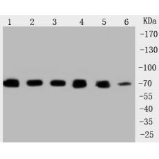 Anti-Grp75 antibody