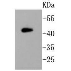 Anti-PHD2 antibody