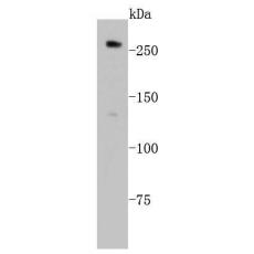 Anti-ABCA1 antibody