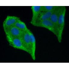 Anti-PDGF Receptor beta antibody