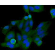 Anti-HIF-1 alpha antibody