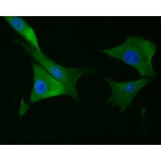 Anti-Calponin-1 antibody
