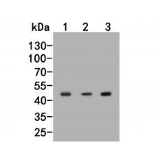 Anti-HSP47 antibody