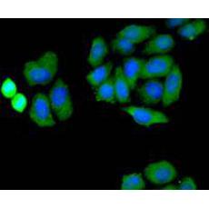 Anti-NADPH oxidase 4 antibody