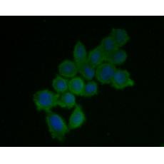 Anti-IFNAR1 antibody