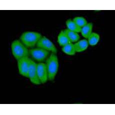 Anti-Bad antibody