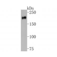Anti-Her2/ErbB2 antibody