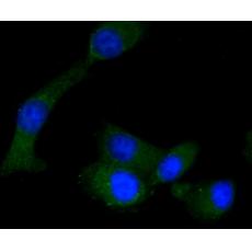Anti-RON antibody