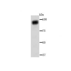 Anti-ACO1 antibody