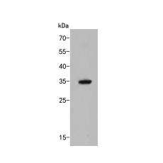 Anti-MTHFD2 antibody