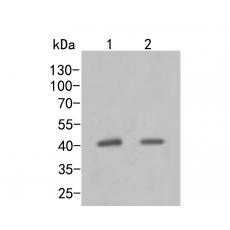 Anti-MVK antibody