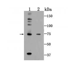Anti-5 Lipoxygenase antibody