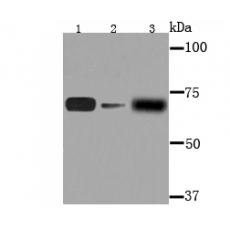 Anti-AFP antibody