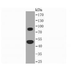 Anti-Thymidine Phosphorylase antibod