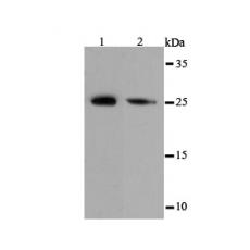 Anti-eIF-4E antibody